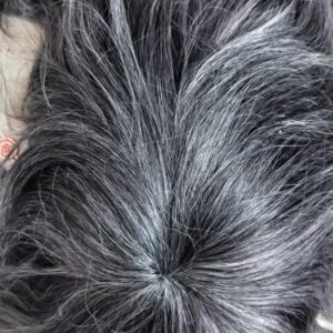 Salt and Pepper | Men's Hair Patch 
